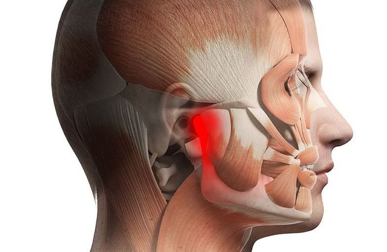 Is stress affecting your jaw joints?